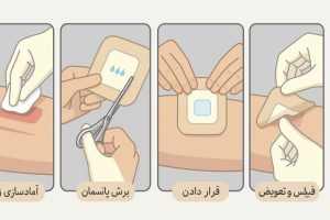 مراحل استفاده از پانسمان بیاتین 