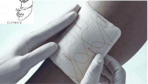 قرار دادن پانسمان 