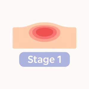 شناسایی زخم بستر 