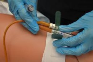 وسایل گذاشتن سوند فولی 