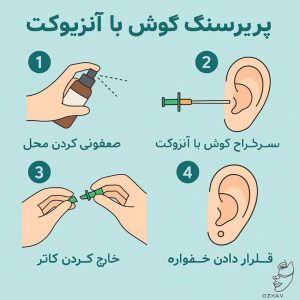 مراحل انجام پیرسینگ 