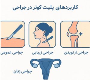 کاربرد پلیت کوتر 