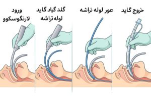 استفاده از گاید 