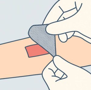 بازکردن پانسمان قبلی