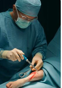 دستکش ارتوپدی در جراحی