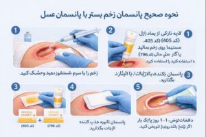 نحوه استفاده از پانسمان عسل برای زخم بستر 