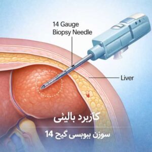 نمونه گیری با سوزن بیوپسی 