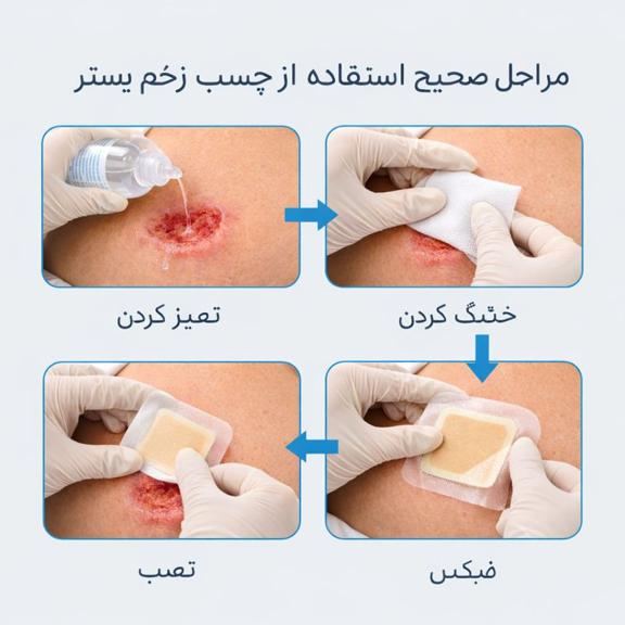 اینفوگرافیک پانسمان زخم بستر