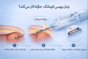 مراحل نمونه گیری 