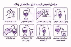 استفاده از یورین بگ 