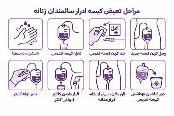 استفاده از یورین بگ