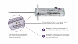 انواع حالت سوزن بیوپسی 