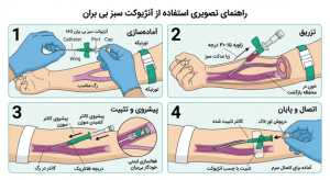 نحوه استفاده از آنژیوکت