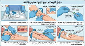 مراحل گام به گام آنژیوکت طوسی