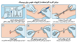 آنژیوکت طوسی پیرسینگ