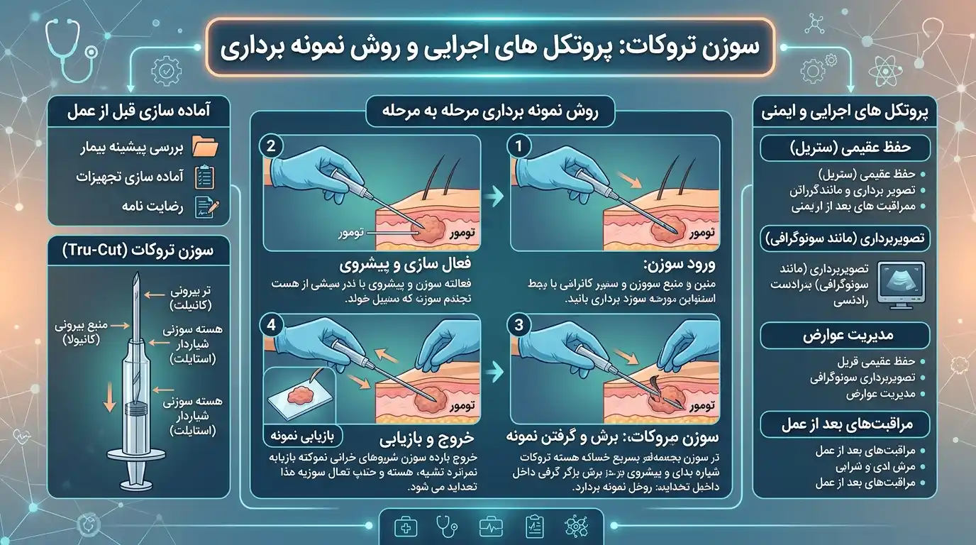 سوزن تروکات : پروتکل های اجرایی و روش نمونه برداری